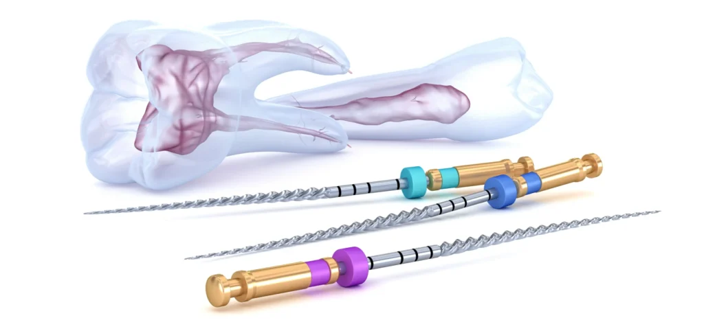 Endodontie - Traitement de canal - Dr Chloé Haas à Brumath